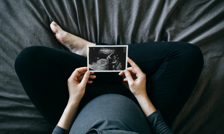 Gravid kvinna ser på ultraljusbild