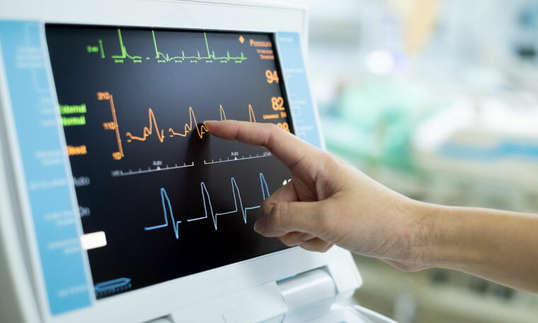 Finger pekar över EKG-kurva