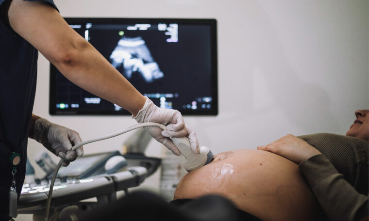 ultraljud på gravid kvinnas mage. Det tar lång tid för kroppen att återhämta sig efter en graviditet